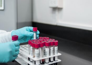 Puławski instytut z propozycją dla olimpijczyków. Szansa na pierwsze doświadczenie w laboratorium